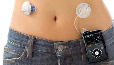 Нова технологія допоможе майбутнім мамам справлятися з діабетом