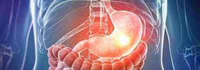 Аденокарцинома шлунку: види і стадії, прогноз на різних стадіях, лікування