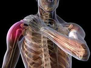 Адгезивний капсуліт плечового суглоба (плеча): симптоми і лікування народними засобами | Ревматолог