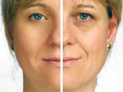 Аевіт для шкіри навколо очей від зморшок: відгуки косметологів, як застосовувати вітамін