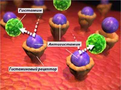Алергічний риніт: симптоми і лікування у дорослих