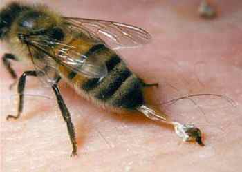 Алергія на бджіл і її смертельні наслідки