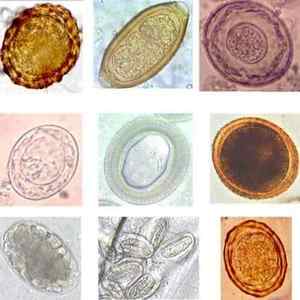 Аналіз калу на гельмінти і їх яйця: підготовка і здача дослідження
