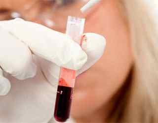 Аналіз крові на гельмінти: наявність антитіл в дослідженні ІФА