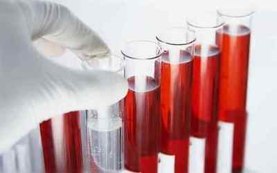 Аналіз крові на паразитів: ІФА та інші методи + розшифровка показників