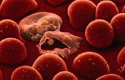 Аналіз крові на виявлення паразитів у дорослих