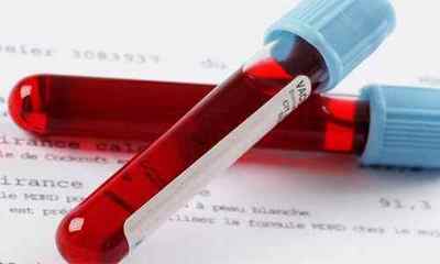 Аналіз крові на ВПЛ: проведення, підготовка, розшифровка