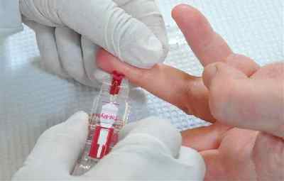 Аналіз крові з пальця здають натщесерце чи ні