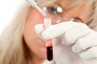 Аналіз на амебіаз: дослідження крові і калу на кишкового паразита