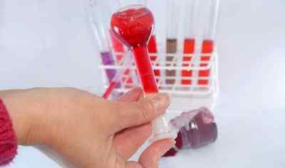 Аналіз на антитіла до поліомієліту, де здати кров