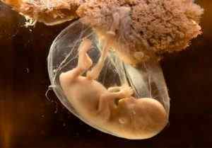 Аналіз на хламідії при вагітності: види, підготовка