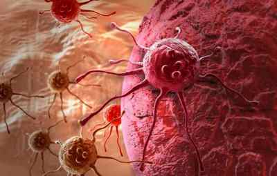 Аналізи крові на ракові клітини в організмі