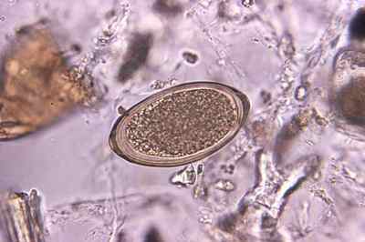 Аналізи на паразитів у дорослих: методи дослідження на наявність гельмінтів в організмі