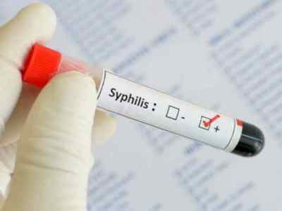 Аналізи на сифіліс після лікування, коли здаються і які повинні бути.