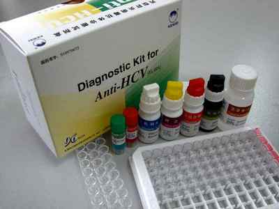 Anti HCV аналіз крові: що це таке, розшифровка