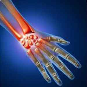 Артрит лучезапястного суглоба: профілактика артрозу і артритів, симптоми і лікування, препарати та фото | Ревматолог