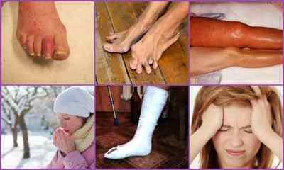 Артрит ніг: симптоми, лікування, фото