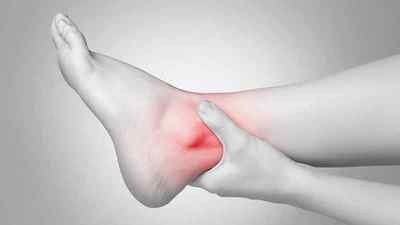 Артрит нижніх кінцівок: симптоми і лікування, артрит пяти і щиколотки, пятковий суглоб, і артрит щиколотки | Ревматолог