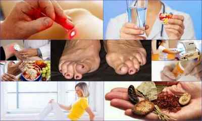 Артрит пальців ніг: симптоми, лікування, причини, фото
