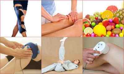 Артроз колінного суглоба 2 ступеня - симптоми і лікування