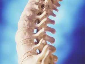 Артроз міжхребцевих суглобів поперекового відділу хребта: лікування деформації в шийному відділі | Ревматолог