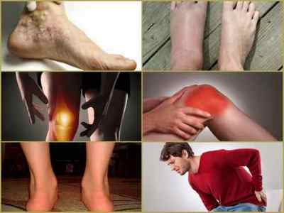 Артроз нижніх кінцівок: симптоми і лікування, фото