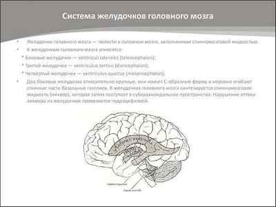 Асиметрія бічних шлуночків головного мозку у дітей та дорослих