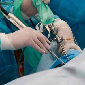 Атроскопія тазостегнового суглоба: що це таке, реабілітація після операції та відгуки, показання | Ревматолог