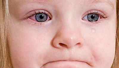 Бактеріальний конюнктивіт очей: лікування у дітей, симптоми, як лікувати у дорослих