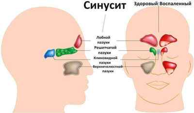 Біль у шиї і в вусі: причини і лікування недуги