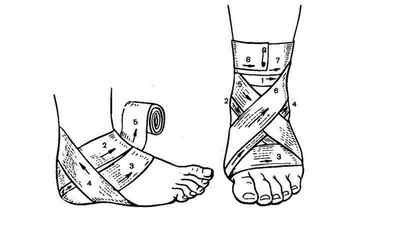 Біль в гомілковостопному суглобі: причини і лікування болю в ступні біля пальців при ходьбі, сухожилля на нозі і верх стопи | Ревматолог