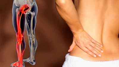 Біль в стегнової мязі: причини і лікування болю мязів на нозі в області стегна, гострий біль в стегні неможливо ходити, тягне мяз | Ревматолог