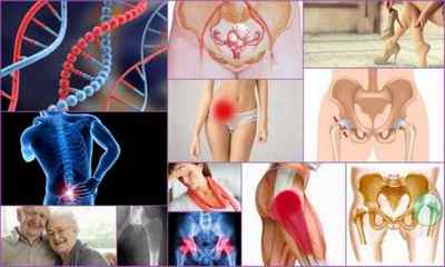 Біль в тазостегновому суглобі при ходьбі - причини і лікування