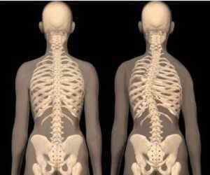 Болі в хребті в грудному відділі: причини і симптоми болю в спині в грудному відділі, що робити і як прибрати сильні болі | Ревматолог