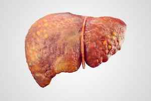 Болі в печінці: причини, види, заходи профілактики