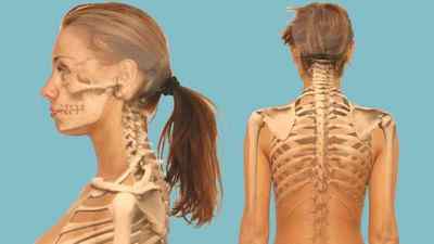 Болі в шийному відділі хребта: причини лікування сильного болю в шиї, плечах і комірцевої зони, тягне мязи шиї з боків | Ревматолог