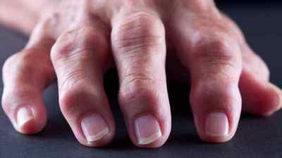 Болі в суглобах рук: причини і лікування, до якого лікаря звернутися, лікування суглобів в домашніх умовах народними засобами | Ревматолог