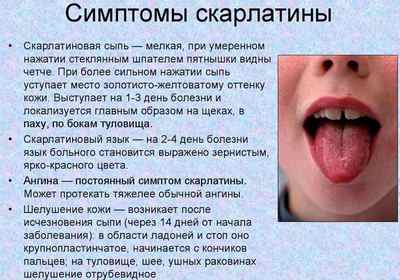 Болить горло і корінь язика при ковтанні: причини, лікування