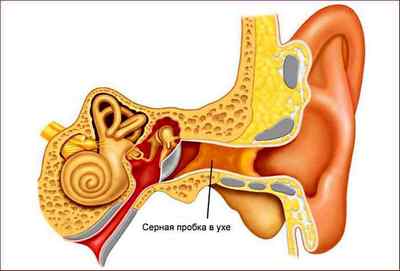 Болить вухо: що робити і як лікувати в домашніх умовах