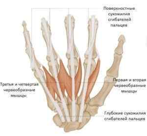 Болять суглоби кисті рук: причини і лікування, що робити, міжфалангові суглоби, хвороби кистей рук і їх лікування, причини | Ревматолог