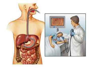 Біопсія кишечника (товстої кишки, прямої і тонкої): показання, хід, результати