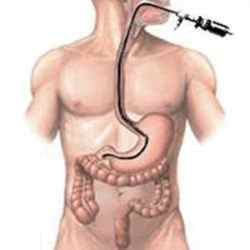 Біопсія кишечника: як проводиться і що показує процедура?