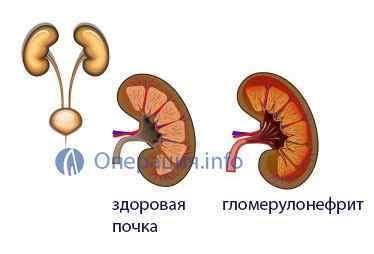 Біопсія нирки (пункція): показання, як проводять, результати