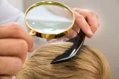 Бородавка на голові в волоссі: причини і лікування