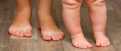 Бородавки на ногах у дітей: причини і лікування