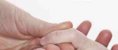 Бородавки у дитини на руках і пальцях: небезпечні наслідки