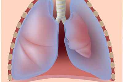 Бронхоектатична хвороба легенів: симптоми, ознаки, лікування