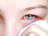 Червоне очне яблуко після удару: чим лікувати, що робити, якщо око почервонів