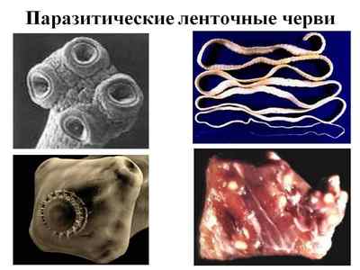Червяки в животі людини: фото паразитів, як допомогти хворому?