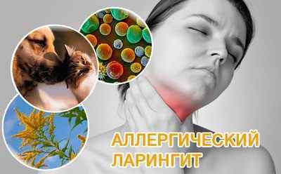 Чи може боліти горло при алергії (алергічний набряк гортані)